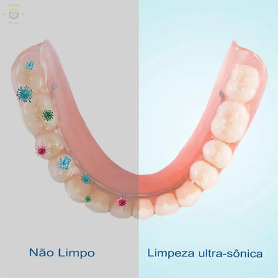 Limpeza Ultrassónica Express